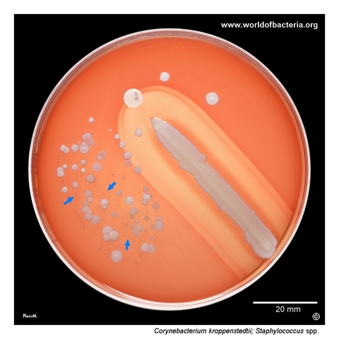Blood agar culture showing Corynebacterium kroppenstedtii colonies among coagulase-negative staphylococci