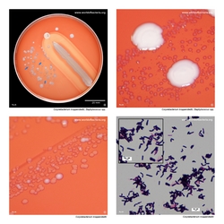Composite laboratory image panel of Corynebacterium kroppenstedtii with preview photographs from the species overview page