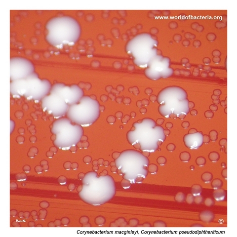 Colonies of Corynebacterium macginleyi and Corynebacterium pseudodiphtheriticum on blood agar