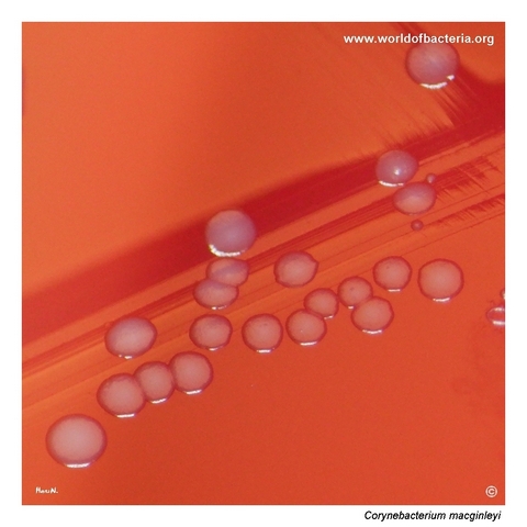 Close-up view of Corynebacterium macginleyi colonies on blood agar
