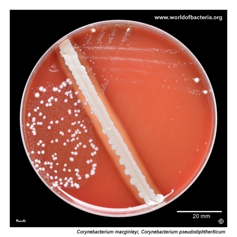 Tiny colonies of Corynebacterium macginleyi with larger colonies of Corynebacterium pseudodiphtheriticum on blood agar
