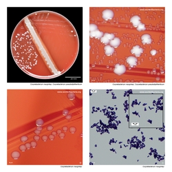 Composite laboratory image panel of Corynebacterium macginleyi with preview photographs from the species overview page