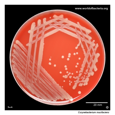 Corynebacterium mucifaciens on blood agar from catheter-drawn positive aerobic blood culture