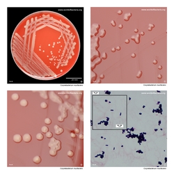 Composite laboratory image panel of Corynebacterium mucifaciens with preview photographs from the species overview page