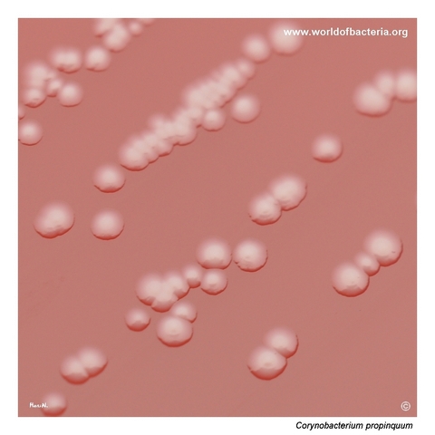 Colonies of Corynebacterium propinquum on blood agar resembling enterococci