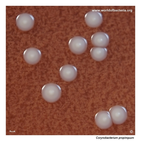 Close-up view of Corynebacterium propinquum colonies on chocolate agar with a raised centre