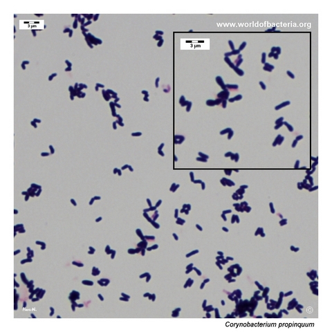 Gram-stained smear from a colony of Corynebacterium propinquum grown on blood agar
