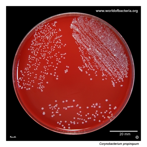 Corynebacterium propinquum on blood agar from a sputum specimen with high colony counts