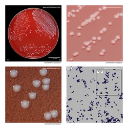 Composite laboratory image panel of Corynebacterium propinquum with preview photographs from the species overview page