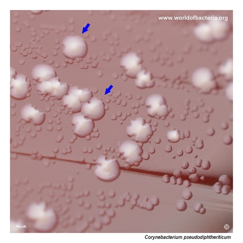 White colonies of Corynebacterium pseudodiphtheriticum with tiny colonies of Corynebacterium macginleyi on blood agar