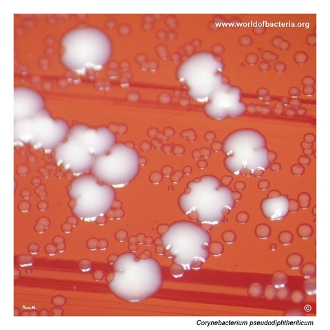 Close-up view of Corynebacterium pseudodiphtheriticum colonies on blood agar