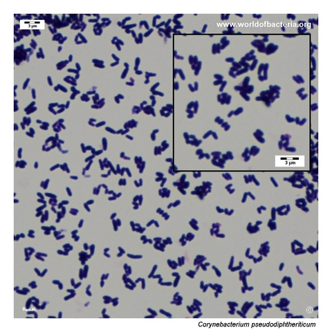 Gram-stained smear from colonies of Corynebacterium pseudodiphtheriticum grown on blood agar