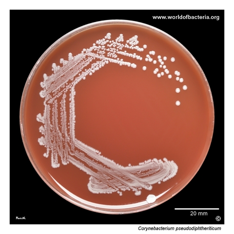 Corynebacterium pseudodiphtheriticum colonies on blood agar from a nasal swab