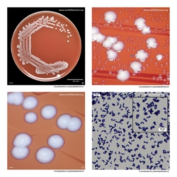 Composite laboratory image panel of Corynebacterium pseudodiphtheriticum with preview photographs from the species overview page
