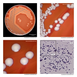 Composite laboratory image panel of Corynebacterium pseudotuberculosis with preview photographs from the species overview page