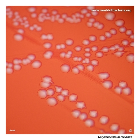 Colonies of Corynebacterium resistens on blood agar