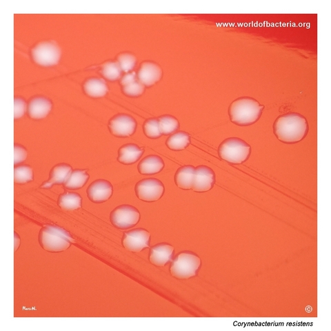 Close-up view of Corynebacterium resistens colonies on blood agar