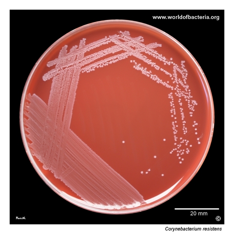 Blood agar culture of Corynebacterium resistens from an aerobic blood culture bottle