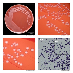 Composite laboratory image panel of Corynebacterium resistens with preview photographs from the species overview page