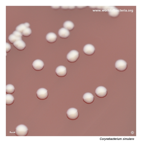 Smooth non-haemolytic colonies of Corynebacterium simulans on blood agar