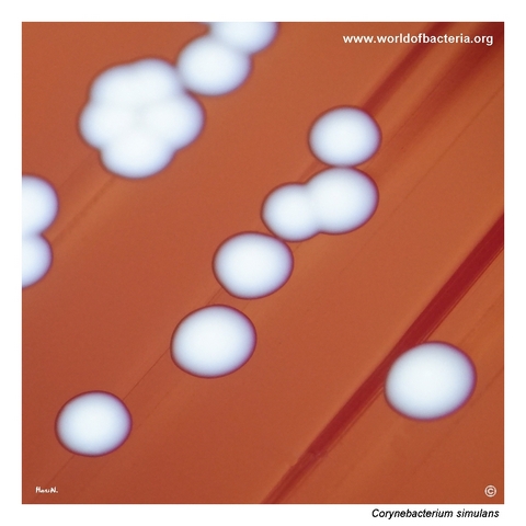 Close-up view of Corynebacterium simulans colonies visually mimicking coagulase-negative staphylococci