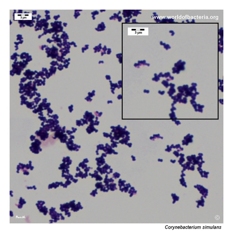 Gram-stained smear of Corynebacterium simulans showing very short Gram-positive coryneform rods
