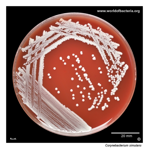 Corynebacterium simulans on blood agar with colonies resembling coagulase-negative staphylococci