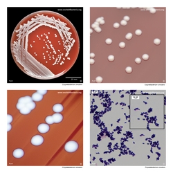 Composite laboratory image panel of Corynebacterium simulans with preview photographs from the species overview page