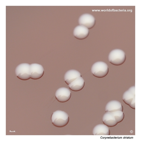 Close-up view of Corynebacterium striatum colonies on blood agar resembling coagulase-negative staphylococci