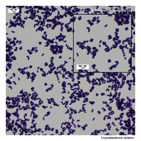 Gram-stained smear of Corynebacterium striatum showing short Gram-positive coryneform rods