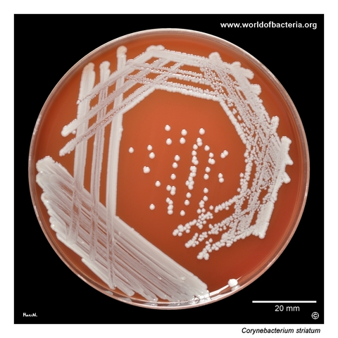 Corynebacterium striatum on blood agar from a lower-limb wound swab