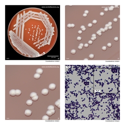 Composite laboratory image panel of Corynebacterium striatum with preview photographs from the species overview page