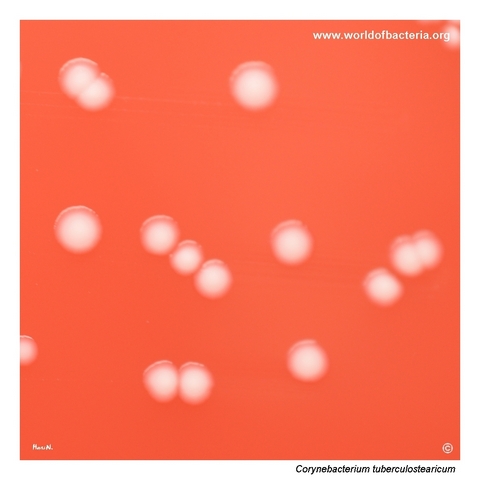 Colonies of Corynebacterium tuberculostearicum on blood agar resembling coagulase-negative staphylococci