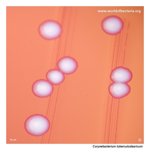 Close-up view of Corynebacterium tuberculostearicum colonies on blood agar