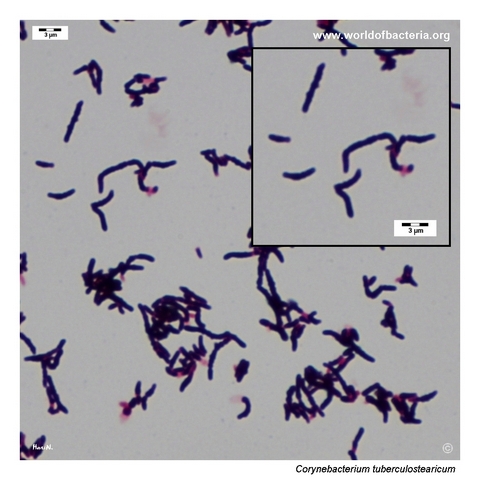 Gram-stained smear from a colony of Corynebacterium tuberculostearicum grown on blood agar