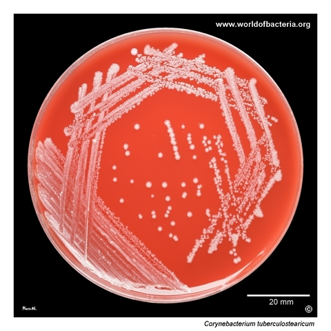 Corynebacterium tuberculostearicum on blood agar from a dialysis catheter specimen