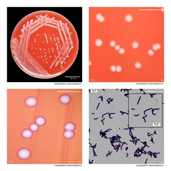 Composite laboratory image panel of Corynebacterium tuberculostearicum with preview photographs from the species overview page