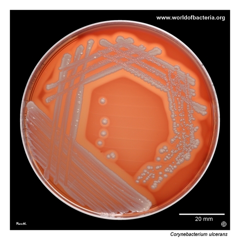 Corynebacterium ulcerans on blood agar from a throat swab in suspected diphtheria