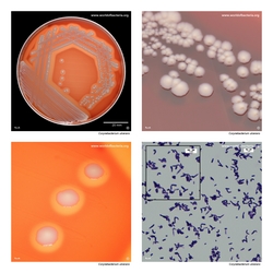 Composite laboratory image panel of Corynebacterium ulcerans with preview photographs from the species overview page