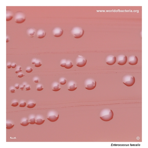 Close-up of Enterococcus faecalis colonies on blood agar