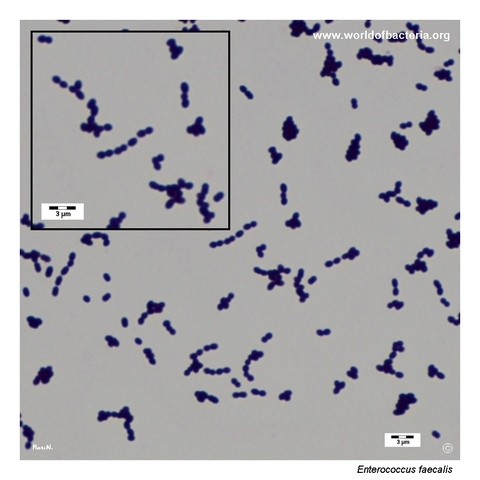 Gram-stained smear of Enterococcus faecalis showing pairs and short chains