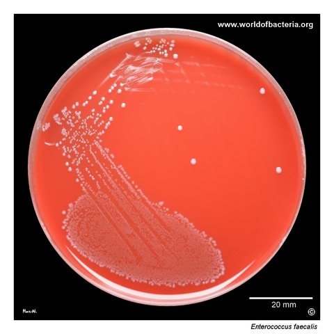 Pure urine culture of Enterococcus faecalis on blood agar