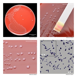 Composite laboratory image panel of Enterococcus faecalis with preview photographs from the species overview page