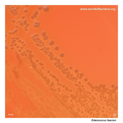 Alpha-haemolytic colonies of Enterococcus faecium on blood agar