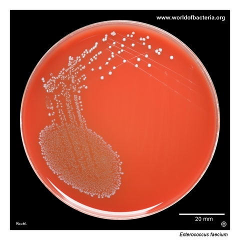 Enterococcus faecium in catheter urine culture on blood agar