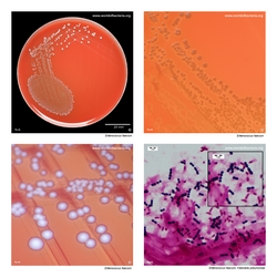 Composite laboratory image panel of Enterococcus faecium with preview photographs from the species overview page