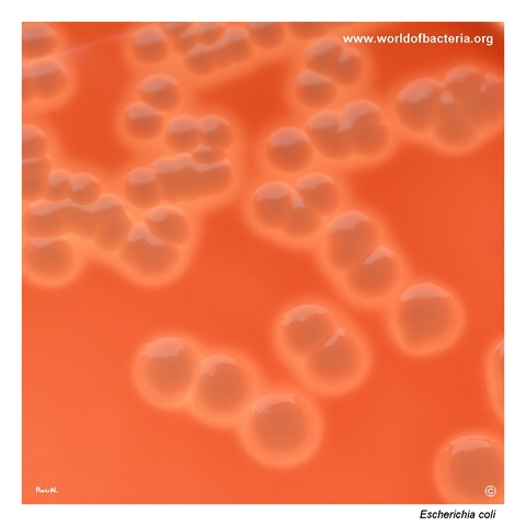 Close-up of smooth grey-white Escherichia coli colonies with prominent beta-haemolysis