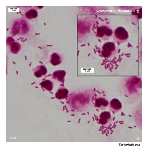 Gram-stained urine specimen with Gram-negative rods and abundant leukocytes