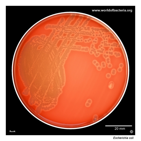 Pure culture of beta-haemolytic Escherichia coli from midstream urine on blood agar