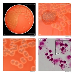 Composite laboratory image panel of Escherichia coli with preview photographs from the species overview page